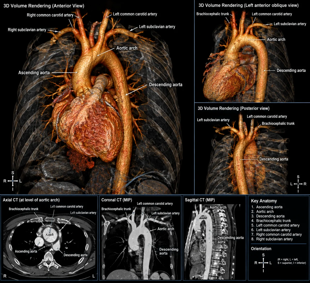 GPT-Image 2.5 生成的正常主動脈 3D CT 重組影像與斷層切面，含英文標示